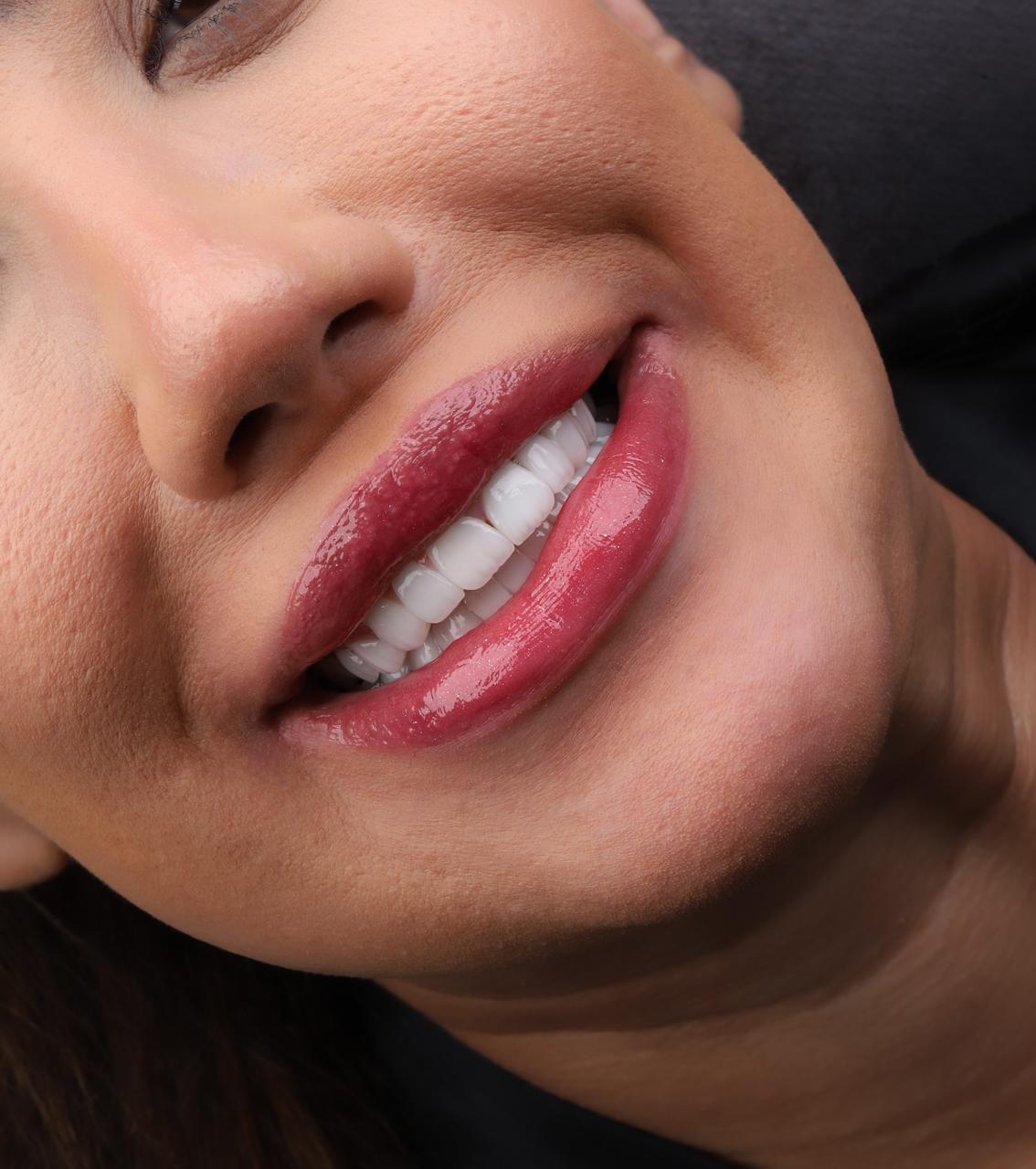 Original dental case photo supplied by the dentist